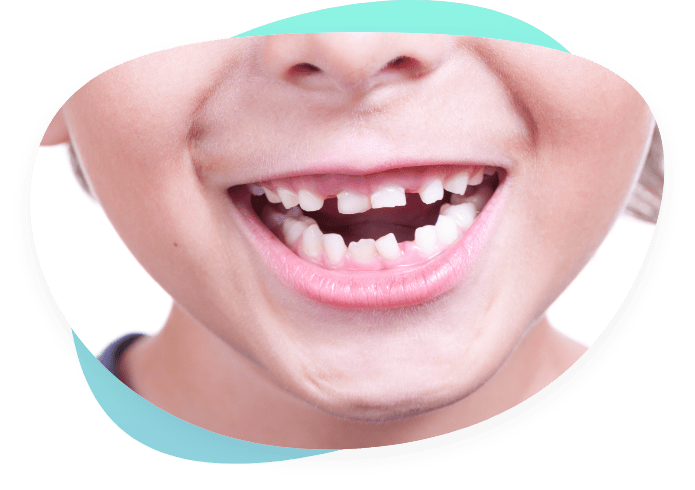 Kinderzähne